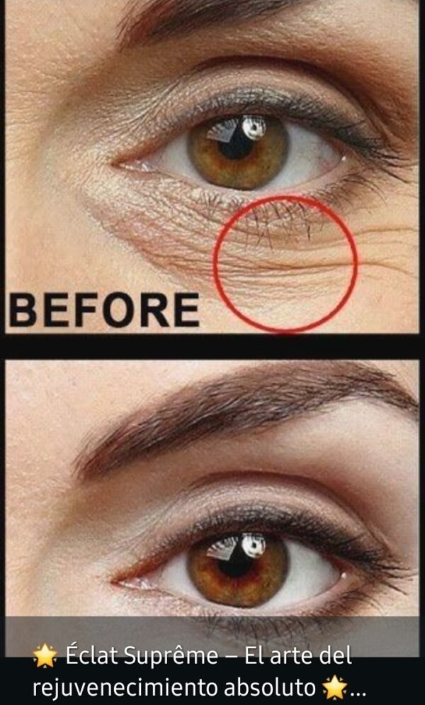 EyesEcleat Renace Eyes Duo Eclat Supreme